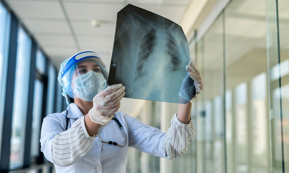 A doctor looking at a chest X-ray