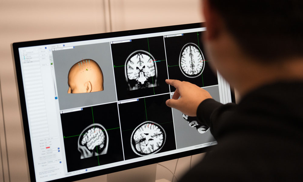 A close-up of a computer screen with images of a brain as seen through a brain scan